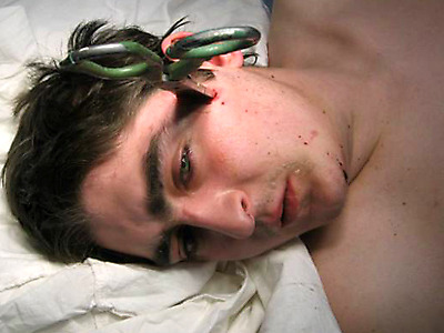scissors impaled on Mark Makarenkov's head